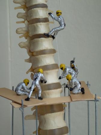 Workmen operating on a spine